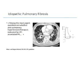 PH due to Lung Disease - comments and proposals - M. Humbert
